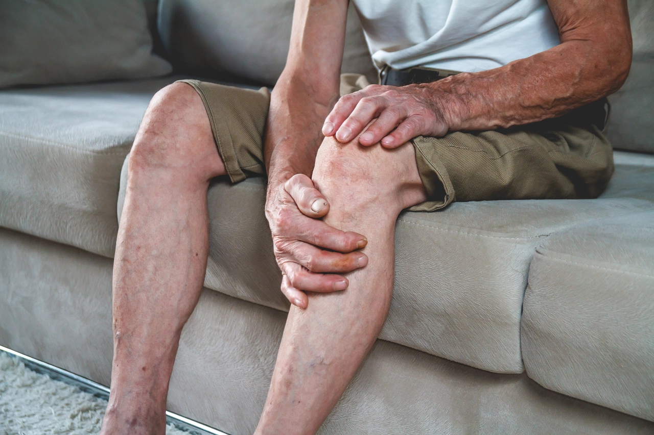Ritenzione idrica e gambe gonfie? La routine serale consigliata dai flebologi per l’estate Ritenzione idrica e gambe gonfie? La routine serale consigliata dai flebologi per l’estate